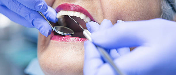 Best Emergency Treatment for Toothache in Santa Nella, CA